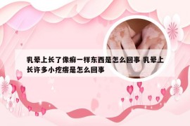 乳晕上长了像癣一样东西是怎么回事 乳晕上长许多小疙瘩是怎么回事