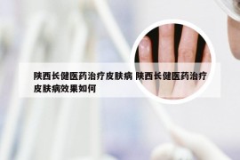 陕西长健医药治疗皮肤病 陕西长健医药治疗皮肤病效果如何