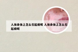 人体身体上怎么引起癣呢 人体身体上怎么引起癣呢