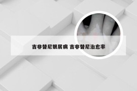 吉非替尼银屑病 吉非替尼治愈率