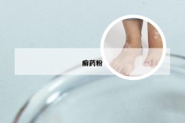 癣药粉