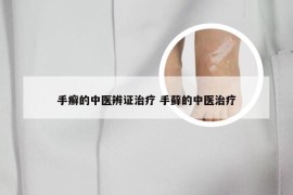 手癣的中医辨证治疗 手藓的中医治疗