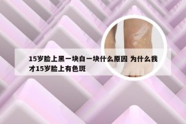 15岁脸上黑一块白一块什么原因 为什么我才15岁脸上有色斑