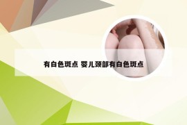 有白色斑点 婴儿颈部有白色斑点