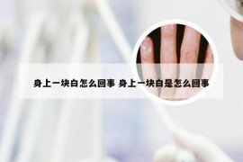 身上一块白怎么回事 身上一块白是怎么回事
