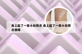 身上起了一些小白斑点 身上起了一些小白斑点很痒