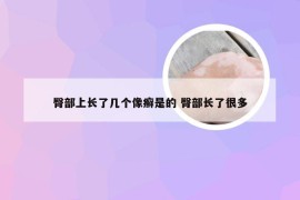 臀部上长了几个像癣是的 臀部长了很多