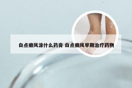 白点癫风涂什么药膏 白点癫风早期治疗药物