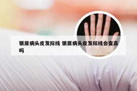 银屑病头皮发际线 银屑病头皮发际线会变高吗