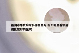 福州市牛皮癣专科哪里最好 福州哪里看银屑病比较好的医院