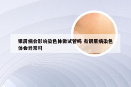 银屑病会影响染色体做试管吗 有银屑病染色体会异常吗