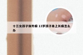 十三女孩子体外癣 13岁孩子身上长癣怎么办