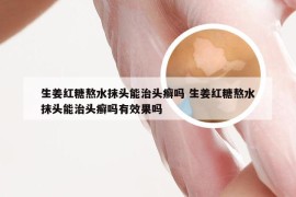 生姜红糖熬水抹头能治头癣吗 生姜红糖熬水抹头能治头癣吗有效果吗
