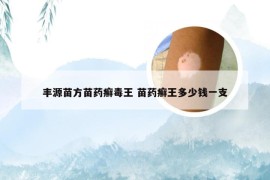 丰源苗方苗药癣毒王 苗药癣王多少钱一支