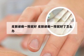皮肤顽癣一擦就好 皮肤顽癣一擦就好了怎么办