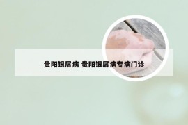 贵阳银屑病 贵阳银屑病专病门诊