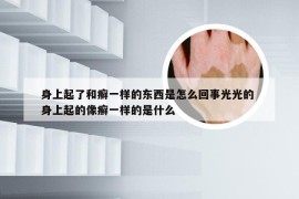 身上起了和癣一样的东西是怎么回事光光的 身上起的像癣一样的是什么