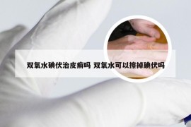 双氧水碘伏治皮癣吗 双氧水可以擦掉碘伏吗