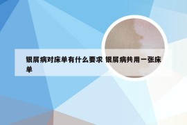 银屑病对床单有什么要求 银屑病共用一张床单