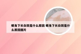 眼角下长白斑是什么原因 眼角下长白斑是什么原因图片