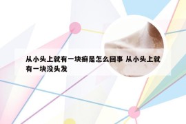 从小头上就有一块癣是怎么回事 从小头上就有一块没头发