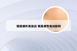 银屑病外用滋润 银屑病专用润肤剂