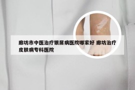 廊坊市中医治疗银屑病医院哪家好 廊坊治疗皮肤病专科医院