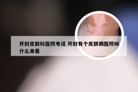 开封皮肤科医院电话 开封有个皮肤病医院叫什么来着