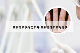 生癣擦药很痒怎么办 生癣擦什么药好得快