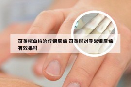 可善挺单抗治疗银屑病 可善挺对寻常银屑病有效果吗