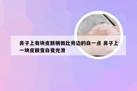 鼻子上有块皮肤稍微比旁边的白一点 鼻子上一块皮肤变白变光滑