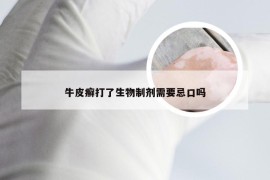 牛皮癣打了生物制剂需要忌口吗