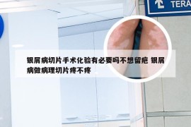 银屑病切片手术化验有必要吗不想留疤 银屑病做病理切片疼不疼