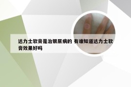 达力士软膏是治银屑病的 有谁知道达力士软膏效果好吗
