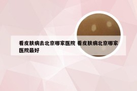 看皮肤病去北京哪家医院 看皮肤病北京哪家医院最好
