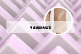 牛皮癣能去浴室