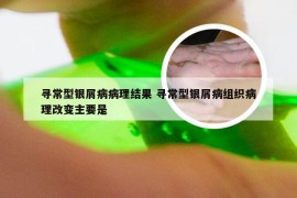 寻常型银屑病病理结果 寻常型银屑病组织病理改变主要是