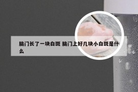 脑门长了一块白斑 脑门上好几块小白斑是什么