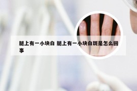 腿上有一小块白 腿上有一小块白斑是怎么回事