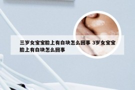 三岁女宝宝脸上有白块怎么回事 3岁女宝宝脸上有白块怎么回事