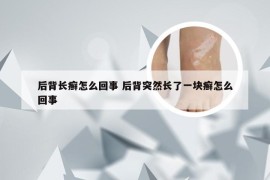 后背长癣怎么回事 后背突然长了一块癣怎么回事