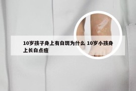 10岁孩子身上有白斑为什么 10岁小孩身上长白点痘