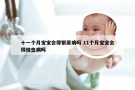 十一个月宝宝会得银屑病吗 11个月宝宝会得蛲虫病吗
