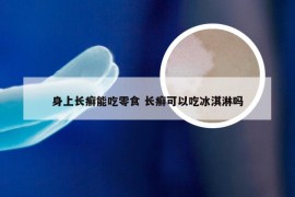 身上长癣能吃零食 长癣可以吃冰淇淋吗