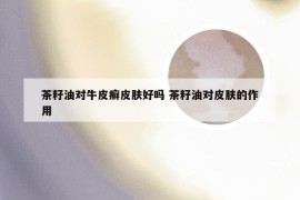 茶籽油对牛皮癣皮肤好吗 茶籽油对皮肤的作用