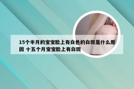 15个半月的宝宝脸上有白色的白斑是什么原因 十五个月宝宝脸上有白斑