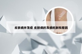 皮肤病并发症 皮肤病的发病机制和原因