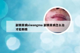 副银屑病siwangma 副银屑病怎么治才能断根