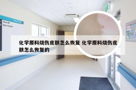 化学原料烧伤皮肤怎么恢复 化学原料烧伤皮肤怎么恢复的