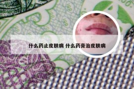 什么药止皮肤病 什么药膏治皮肤病